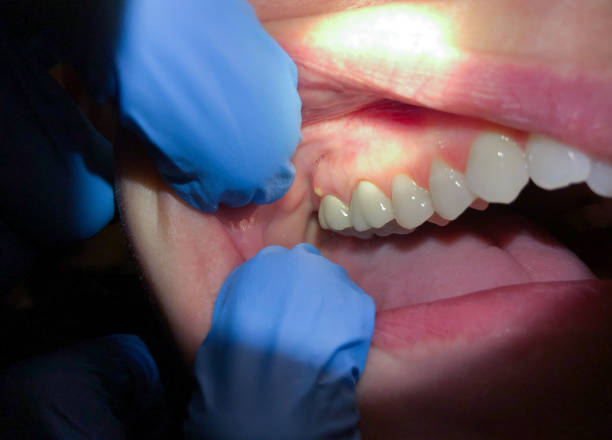Best Urgent Dental Care for Toothache in Murphys Estates, SC