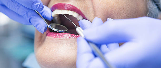 Best Emergency Dentist for Knocked-Out Tooth in Murphys Estates, SC